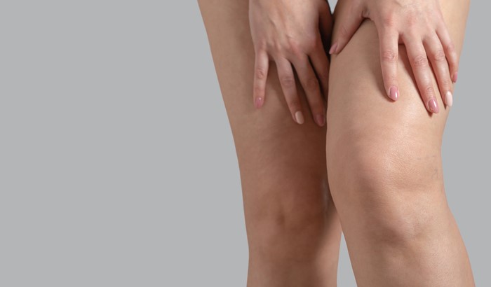 女性のまたずれは何が原因？またずれ対策とおすすめアイテム