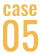 case 05